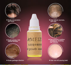 Hair Growth & Anti-Hair Loss Liquid – 20ml
